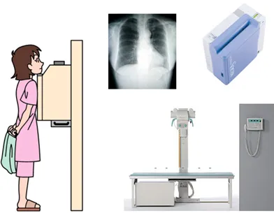 肺や心臓の病気を調べる「胸部X線検査(レントゲン)」